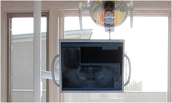 くぼた歯科クリニックのデジタルモニター設備
