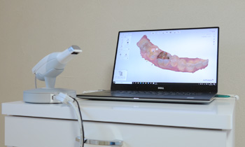 くぼた歯科クリニックの口腔内スキャナ